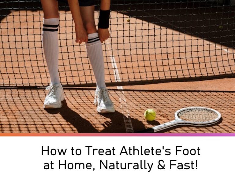 How to Treat Athlete's Foot at Home