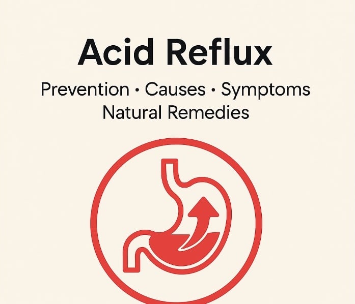 Acid Reflux