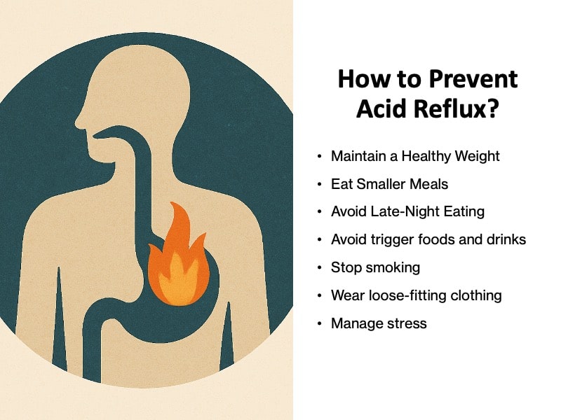 How to Prevent Acid Reflux