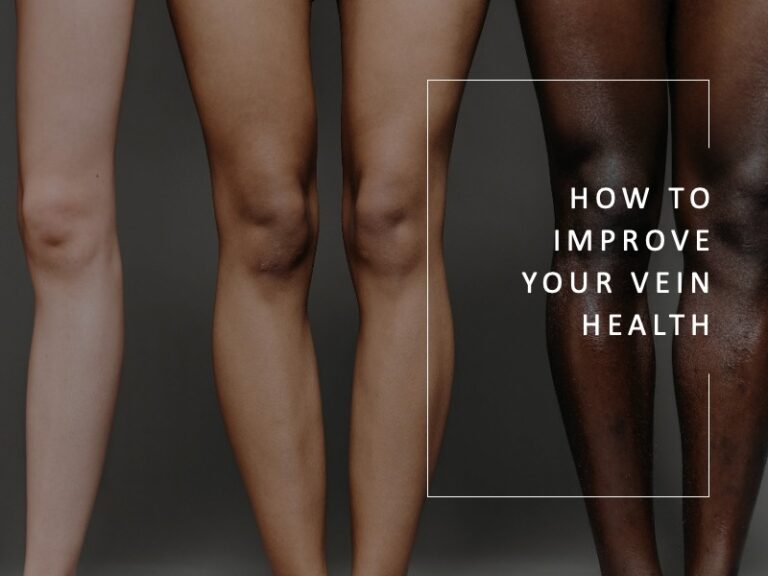 How to Improve Your Vein Health