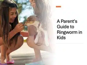 Ringworm in Kids